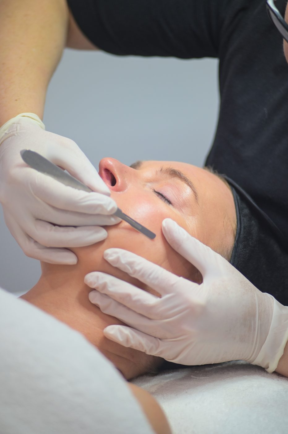 Epi Smooth dermaplaning at Beauty on Rose