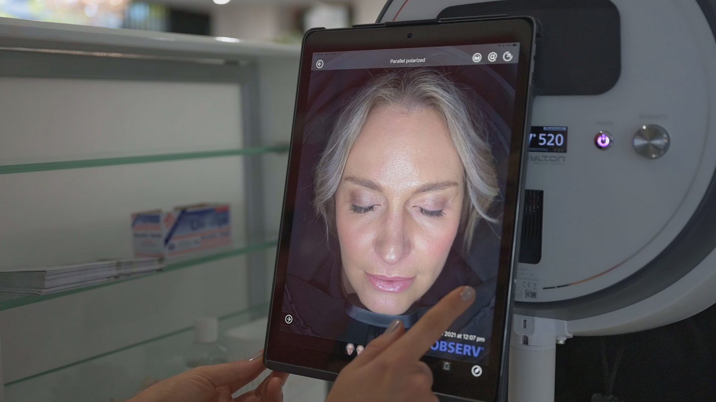 Skin Scan and Plan consultation using OBSERV skin analysis