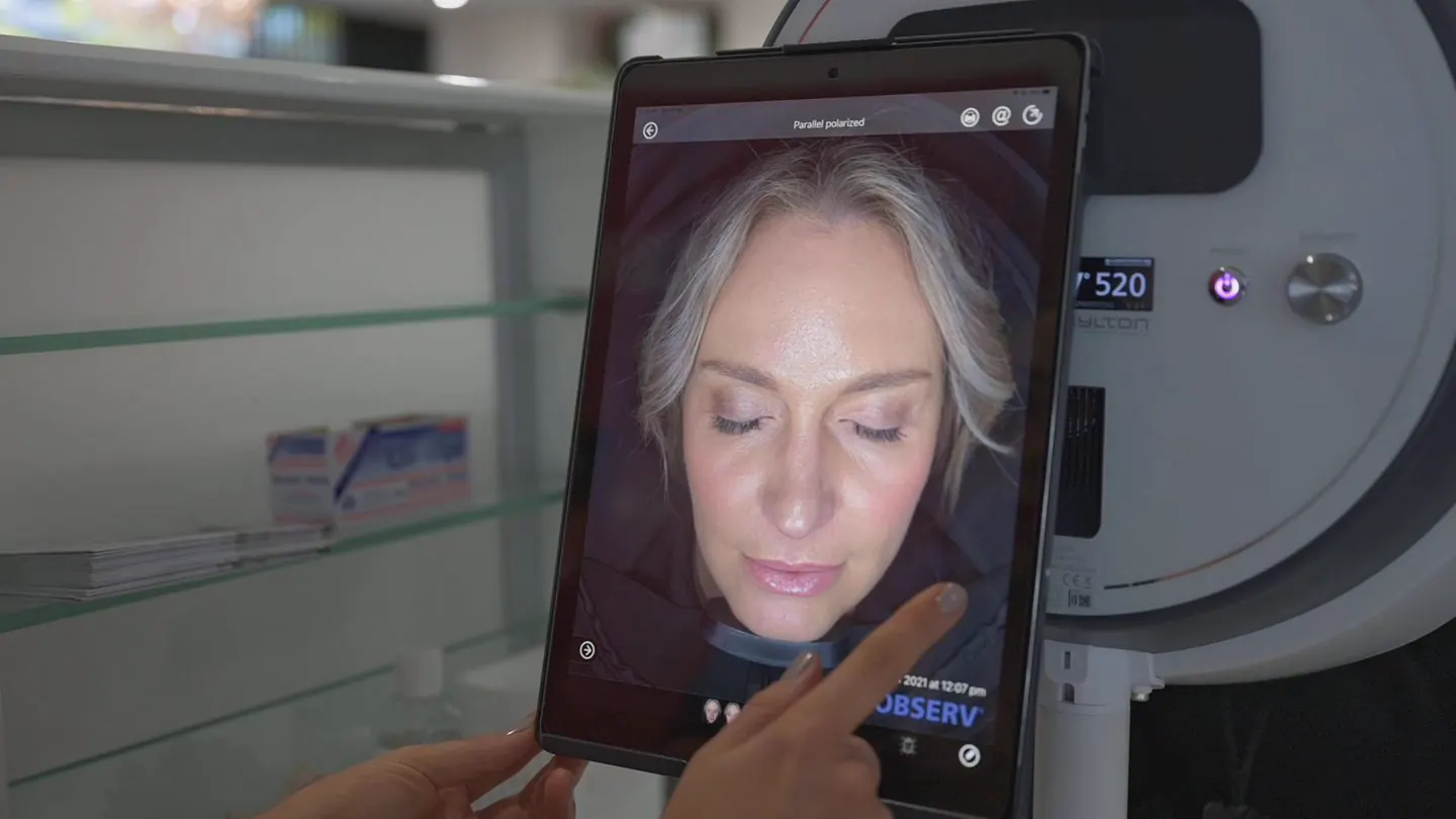 Skin Scan and Plan consultation using skin analysis imaging